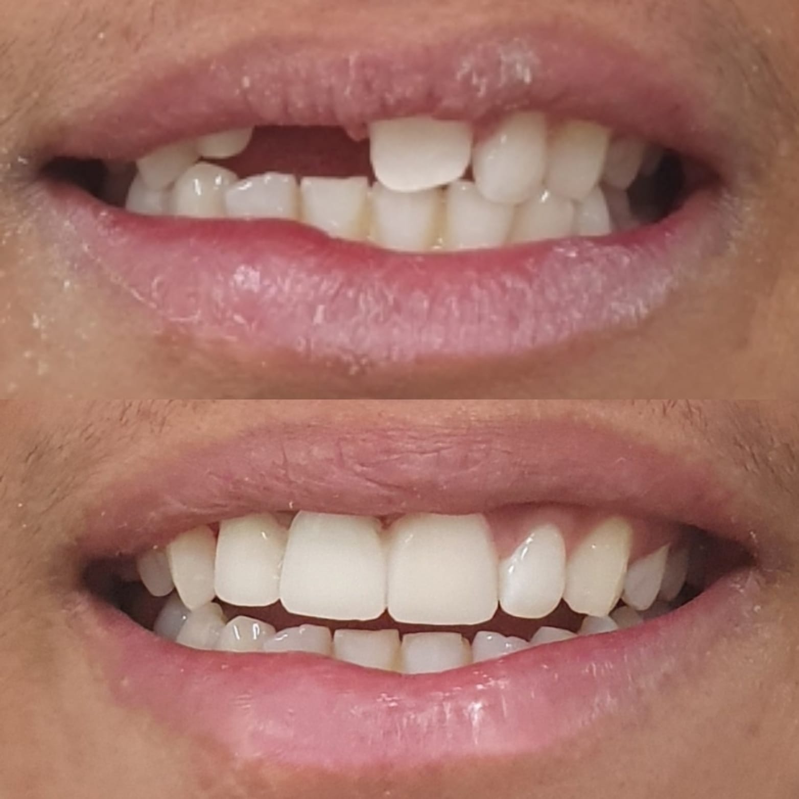 Dental Transformation